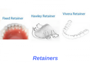 Orthodontic Retainers – Oceansight Dental & Implants