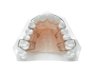 Orthodontic Retainers – Oceansight Dental & Implants